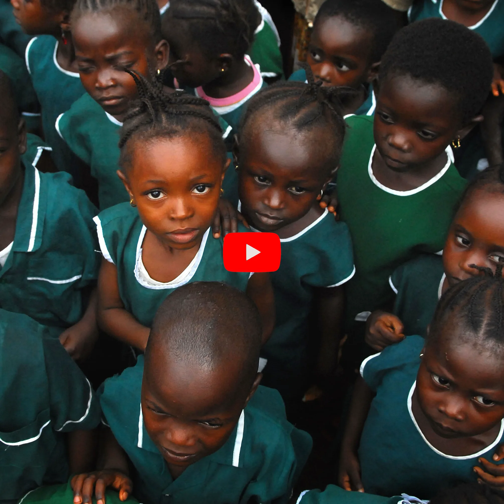 Watch: Haiti Conjoined Twin Separation