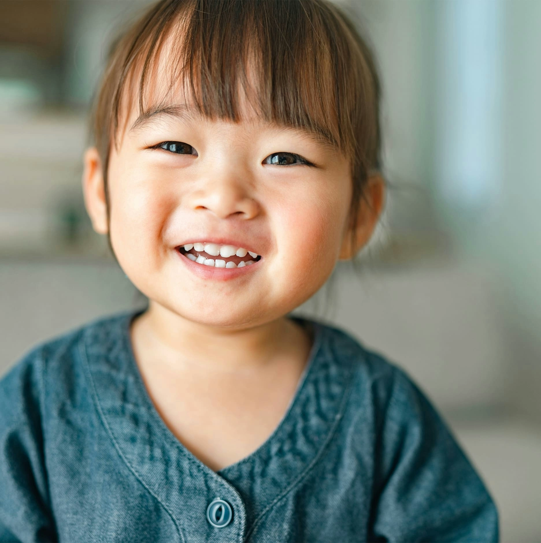 Moebius syndrome signs and symptoms