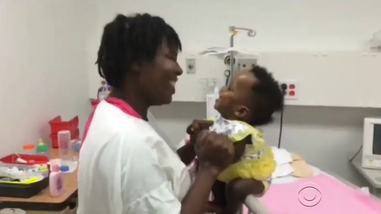 Haiti's First Conjoined Twin Separation - CBS