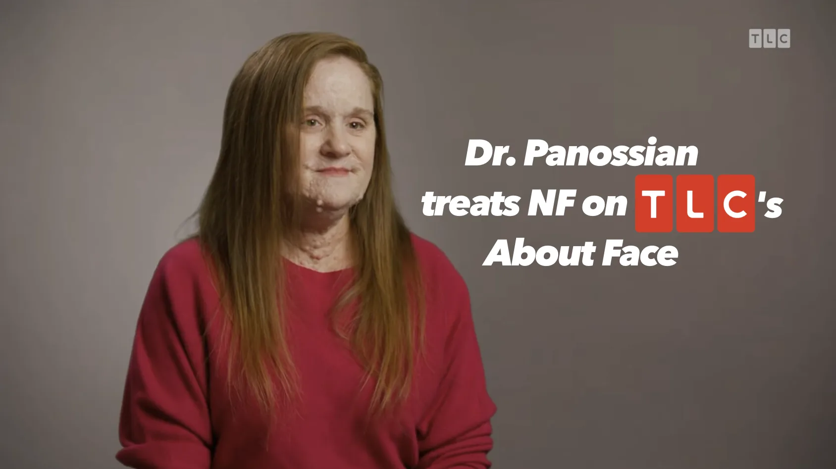 NF patient journey featured on TLC's About Face