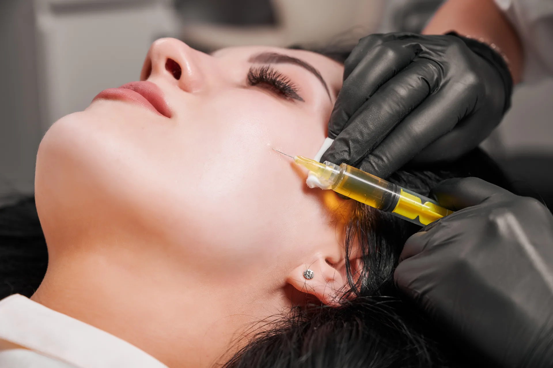 Facial fat transfer with Dr. Panossian