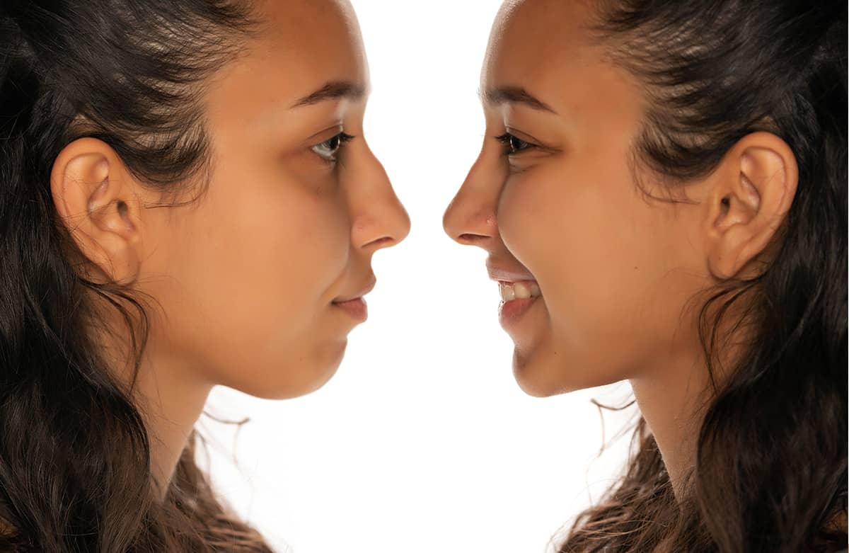 5 Reasons People Seek Out an Ethnic Rhinoplasty