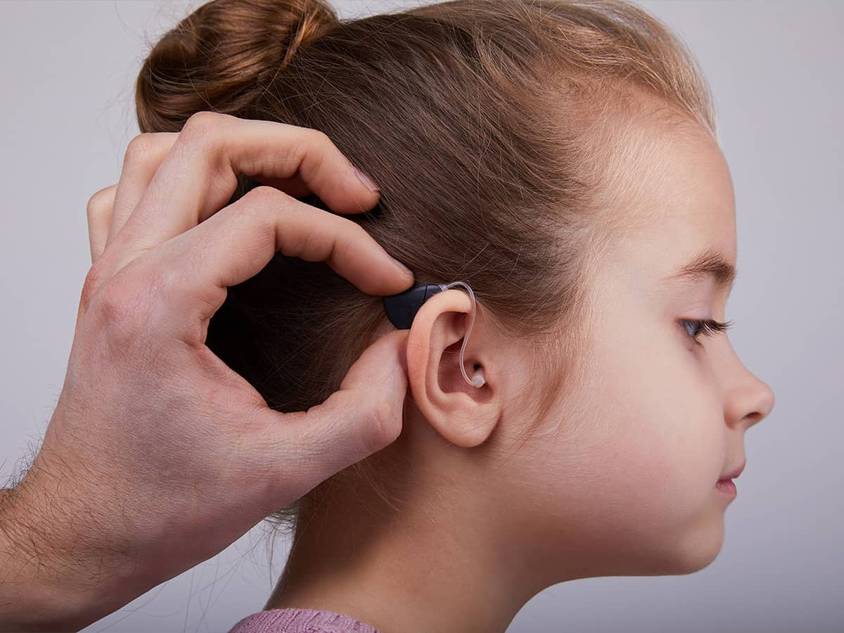 How Microtia and Atresia Affect Hearing and Speech in Children