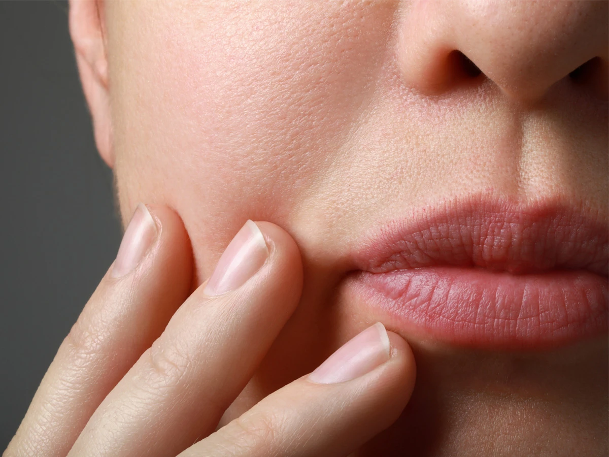 Lip Reduction Surgery Recovery