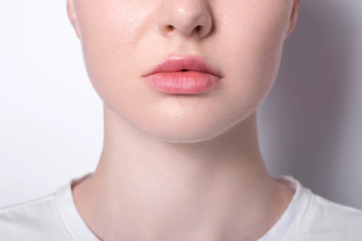 Correcting Asymmetrical Lips with Surgery