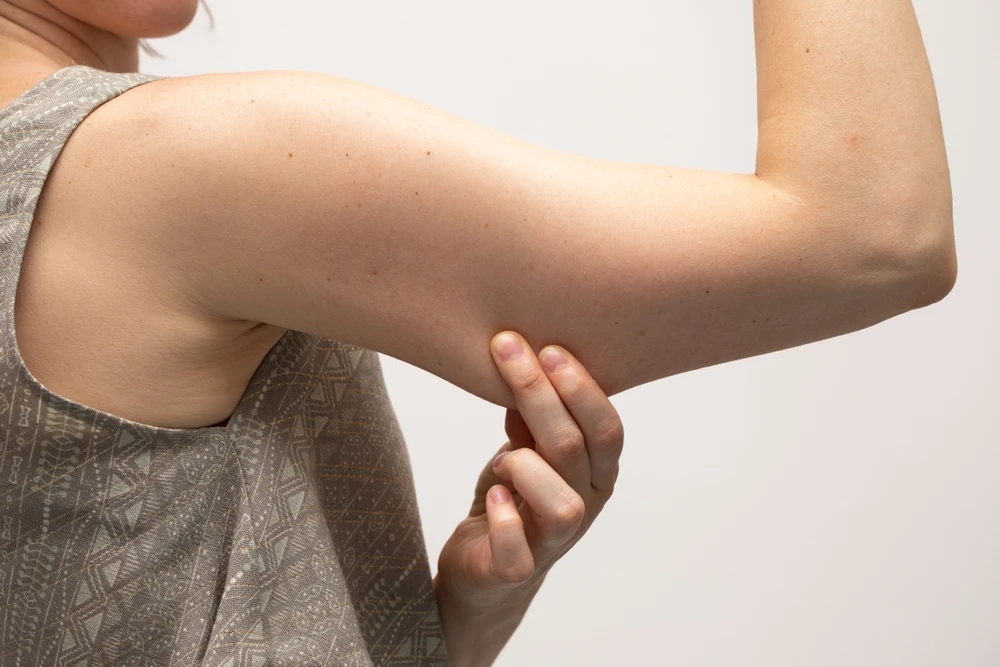 Mini Arm Lift: A Less Invasive Option