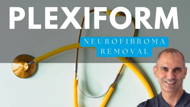 Removing Plexiform Neurofibroma | Explained by NF Surgeon