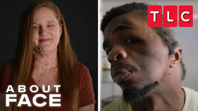About Face — TLC Series